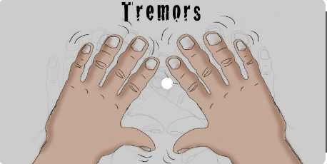 tremor 1